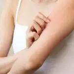 Dermatology